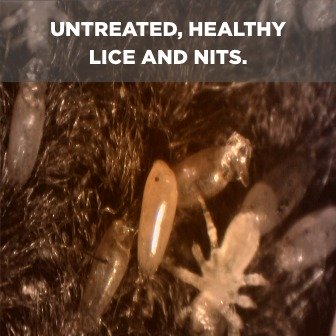 Lice Life Cycle 1